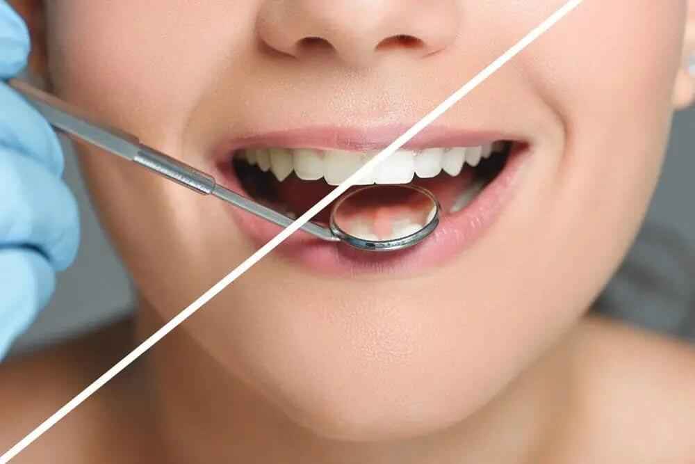 Ultrasonic Dental Care for a Healthier Smile - CURVY MOON