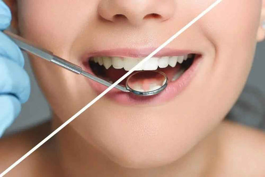 Ultrasonic Dental Care for a Healthier Smile - CURVY MOON