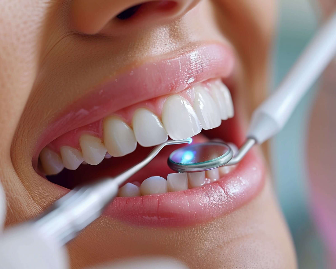 Ultrasonic Dental Scalers | Remove Tartar and Keep Teeth Healthy - CURVY MOON